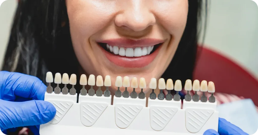 porcelain veneers