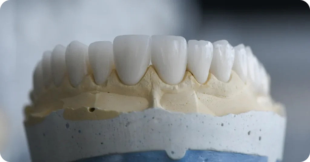 dental crowns